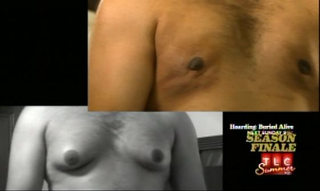 Illustration for article titled One Man's Struggle With His 'Man Boobs'